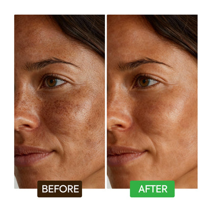 Kojic Acid Dark Spot Remover Soap Bars - Image 7