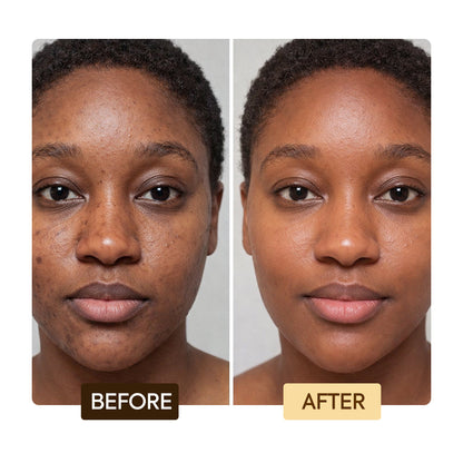 Exclusive Exfoliating Soap - Image 5