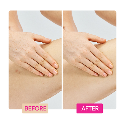 Ginger Extract + Tranexamic Acid + Retinol Body Toning Cream - IYKYK - Image 5