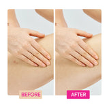 GINGER EXTRACT + TRANEXAMIC ACID + RETINOL BODY TONING CREAM - IYKYK